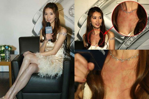 林志玲蔡依林揭秘明星尷尬的怪病